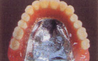 金属床